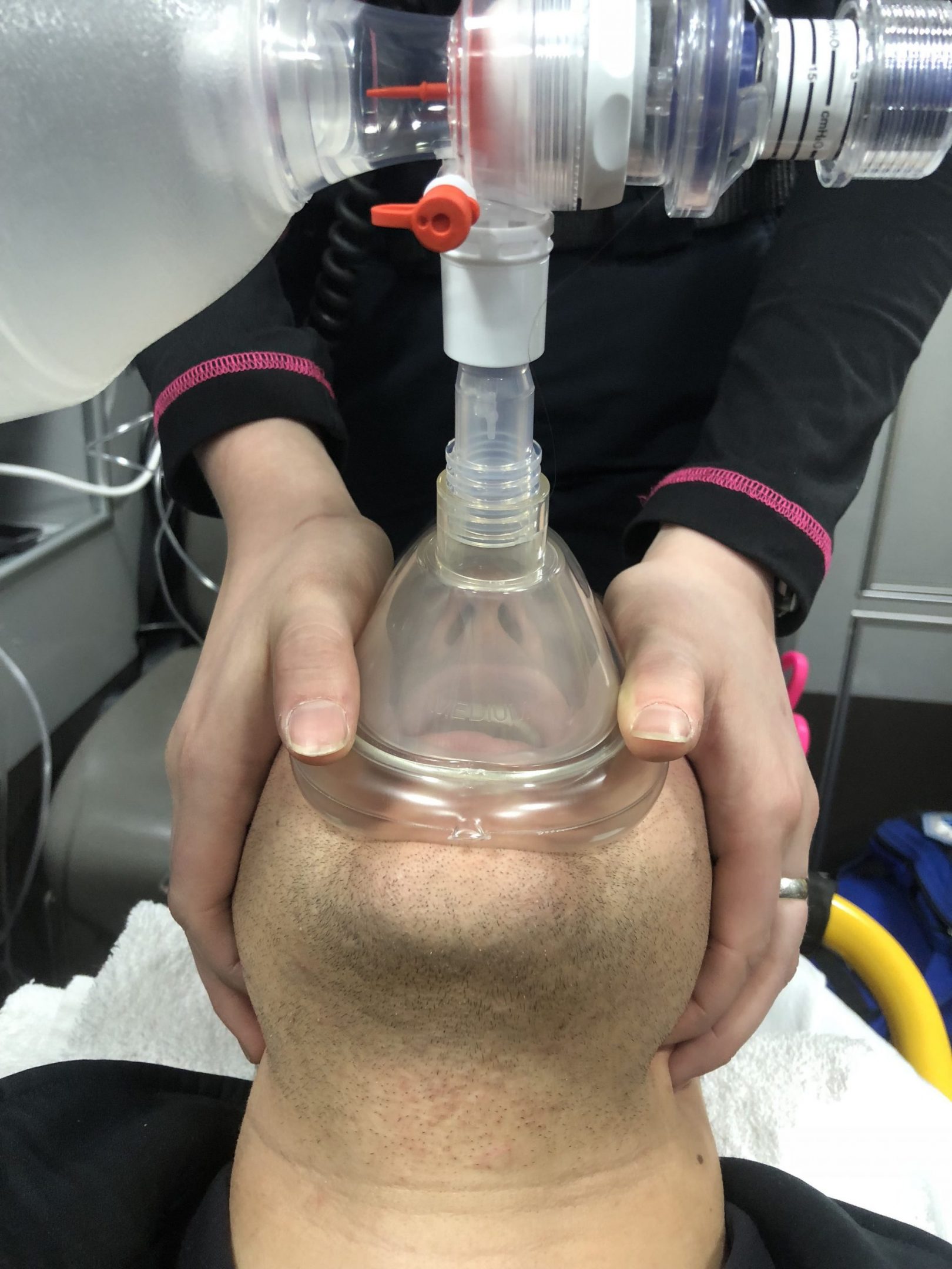 The ideal way to ensure a proper mask seal using a two-person approach is for one provider to place the pads of the hand and the thumbs on the mask, while the second provider uses their index and other fingers to pull the jaw forward maximally.