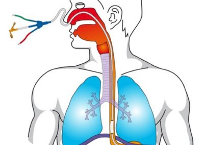 Assessing Acute Shortness of Breath