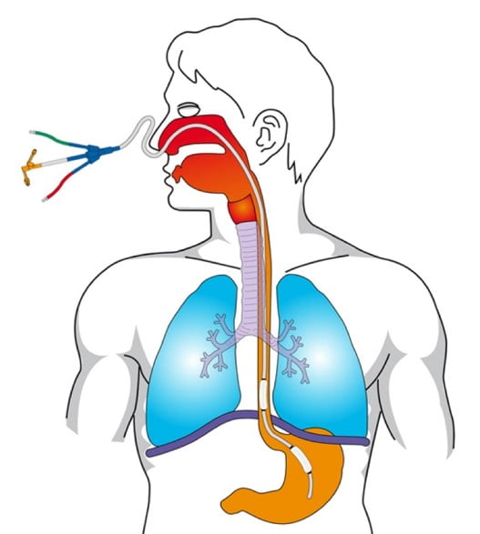 Assessing Acute Shortness of Breath
