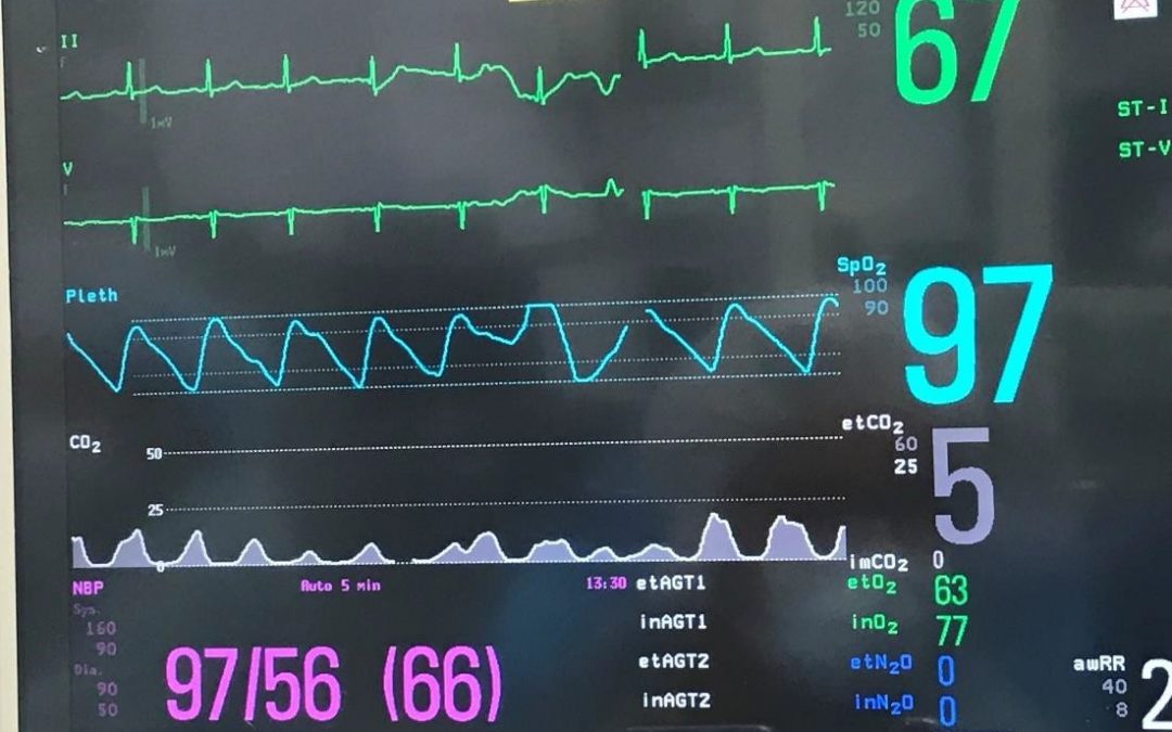 A Systematic Approach to Capnography Waveforms