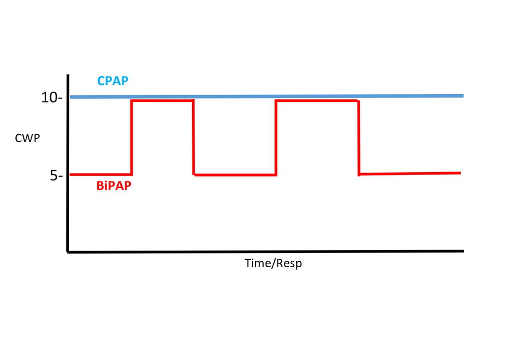 Essentials Of BiPAP EMS Airway   CPAP V BiPAP Edit 