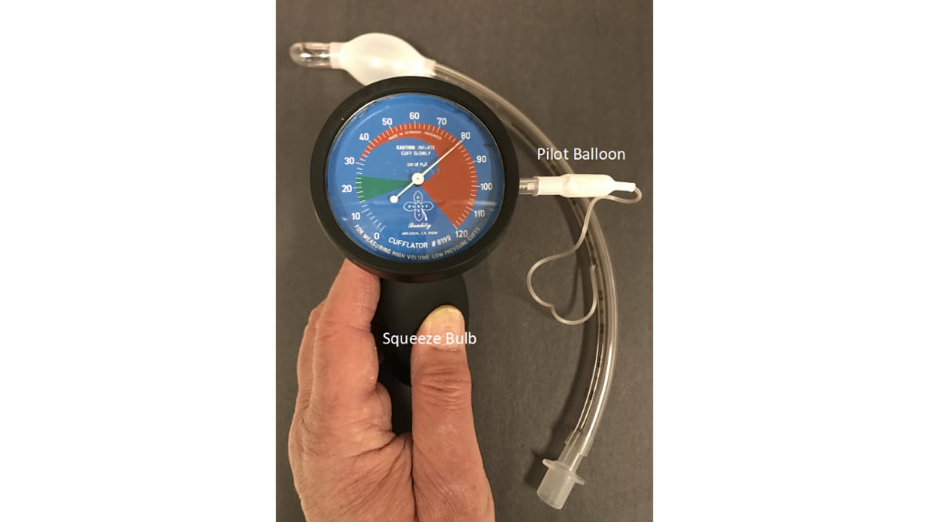 The photo shows an out-of-range cuff pressure at 80 CWP