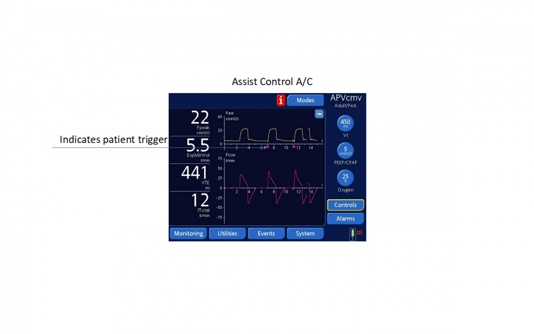 Demystifying Ventilator Modes: It’s Not That Complicated!