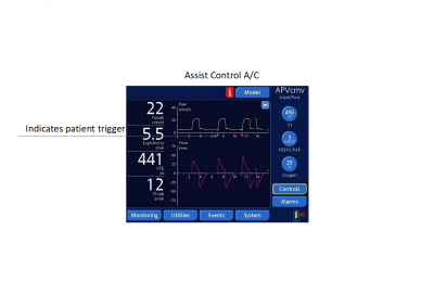 Demystifying Ventilator Modes: It’s Not <i>That</i> Complicated!