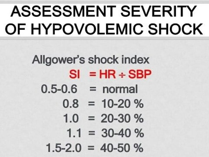 Assessment severity of hypovolemic shock
