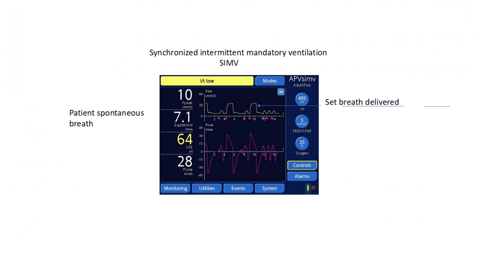 Demystifying Ventilator Modes It’s Not That Complicated! EMS Airway