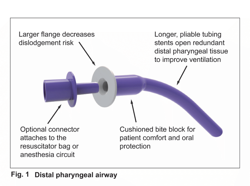 Distal Pharyngeal Airway