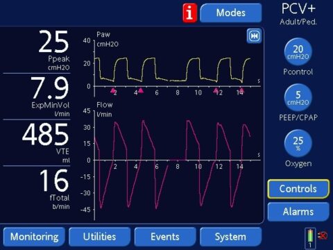 Demystifying Ventilator Modes: It’s Not That Complicated! Part 2 - EMS ...