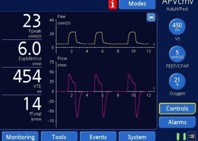 Demystifying Ventilator Modes: It’s Not That Complicated! Part 2