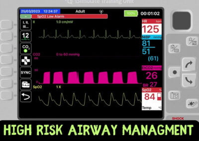 Trauma Airway Management: The Stuff Nightmares Are Made Of (Part 2)