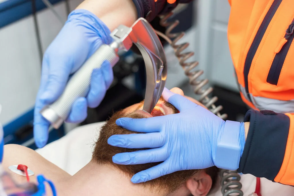 A man on his back has a medical professional insert an airway device down his throat.