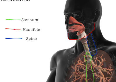 When a Fighter Chokes