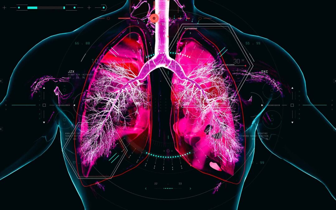 Signals and Noise: Vents and Obstructive Lung Disease – Part 1